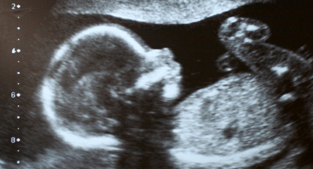 TIFFA Scan Benefits in Prenatal Care